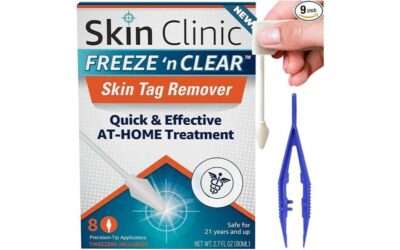 Skin Clinic Freeze 'N Clear Skin Tag Remover Review