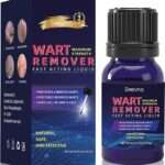 effective treatment for warts